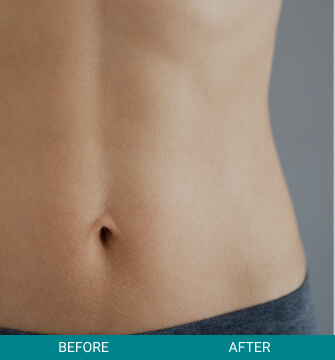 Before & After