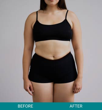 Wellness Longevity