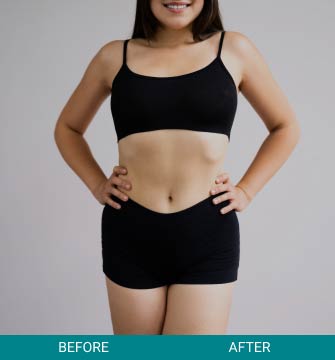 before-after-wellness-longevity-1-b