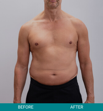before-after-wellness-longevity-2-a