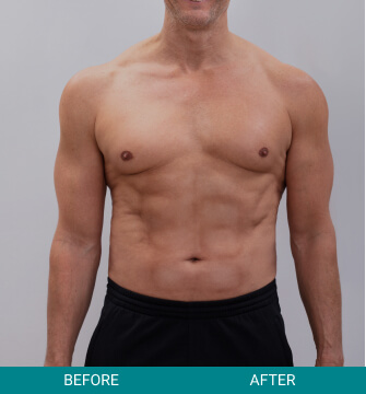 before-after-wellness-longevity-2-b