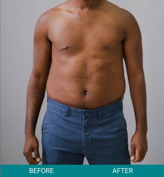 before-after-wellness-longevity-3-a