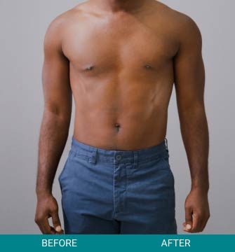 before-after-wellness-longevity-3-b