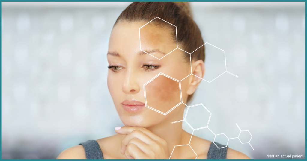 Best Hyperpigmentation Treatments in Northern Virginia
