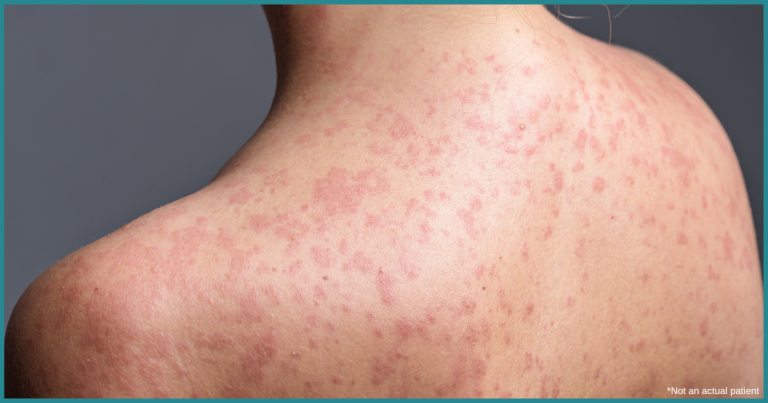 same day dermatology appointment near me Virginia